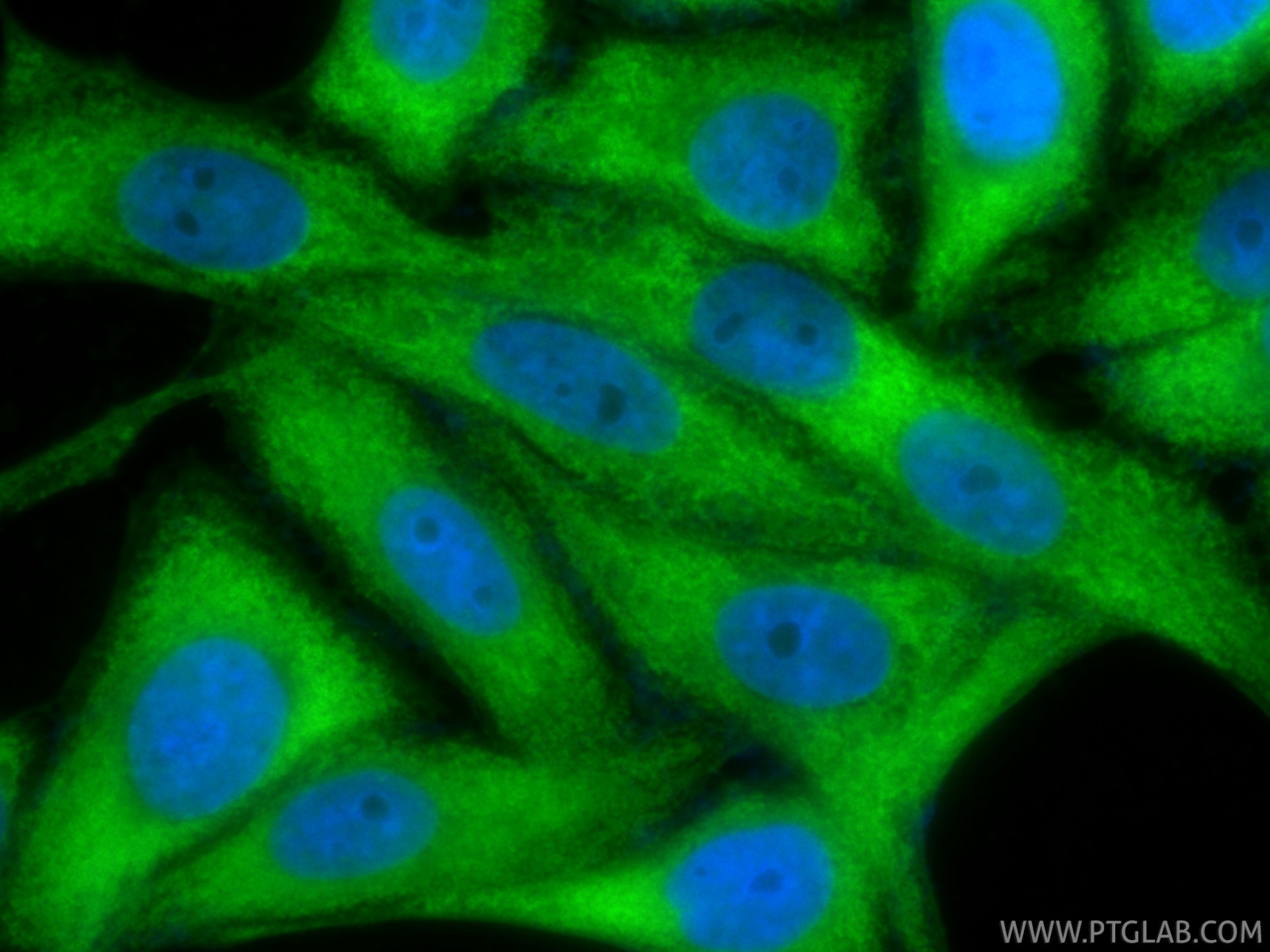 IF Staining of HepG2 using CL488-86699 Immunofluorescence (IF) / fluorescent staining of HepG2 cells using CoraLite® Plus 488-conjugated UGP2 Recombinant mon (CL488-86699)