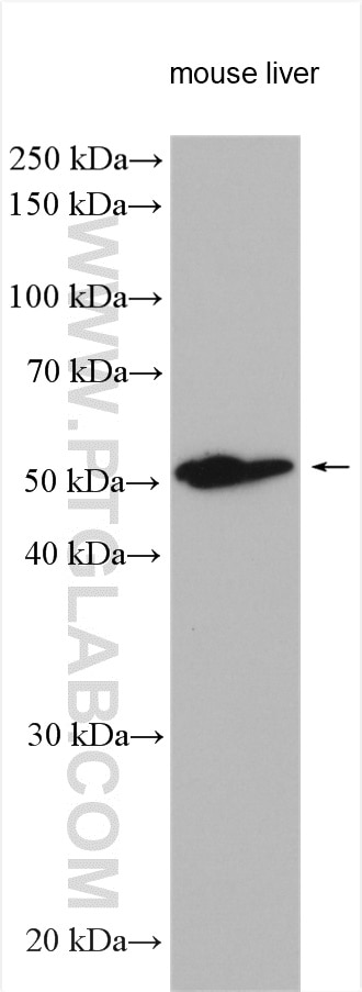 Western Blot (WB) analysis of various lysates using UGT1A1 Polyclonal antibody (23495-1-AP)