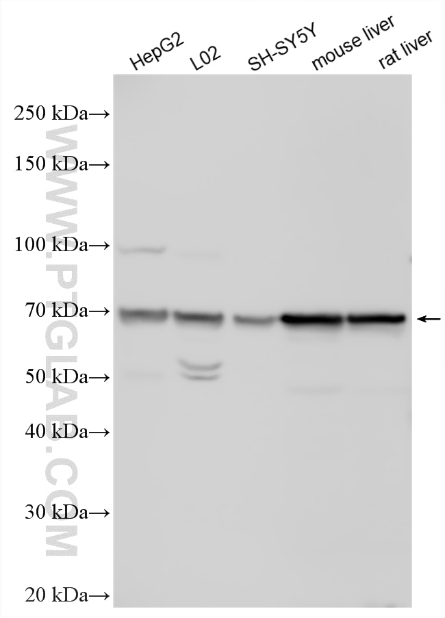Various lysates were subjected to SDS PAGE followed by western blot with 23495-1-AP (UGT1A1 antibody) at dilution of 1:1000 incubated at room temperature for 1.5 hours. Western Blot (WB) analysis of various lysates using UGT1A1 Polyclonal antibody (23495-1-AP)