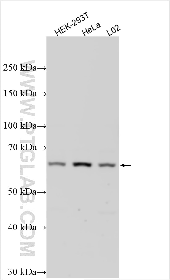 Western Blot (WB) analysis of various lysates using UGT1A10 Polyclonal antibody (14457-1-AP)