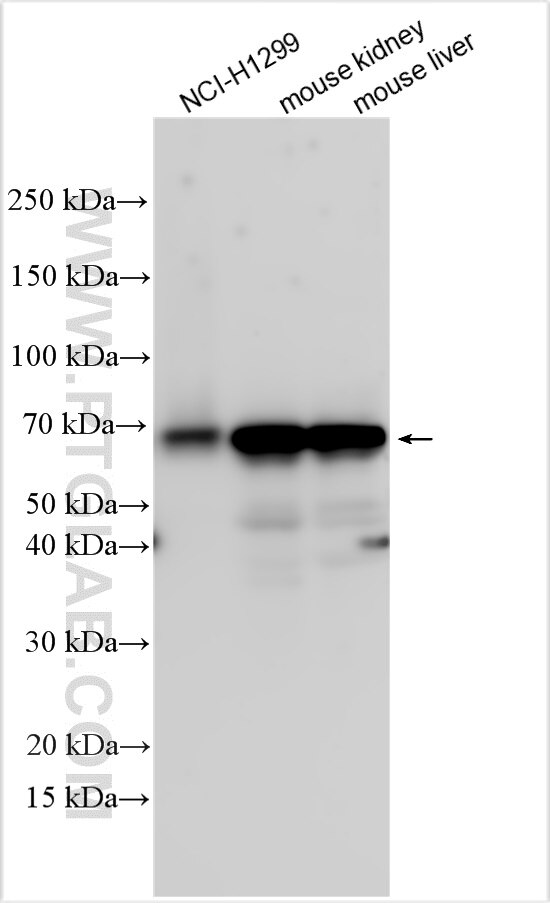 Western Blot (WB) analysis of various lysates using UGT1A6 Polyclonal antibody (23765-1-AP)