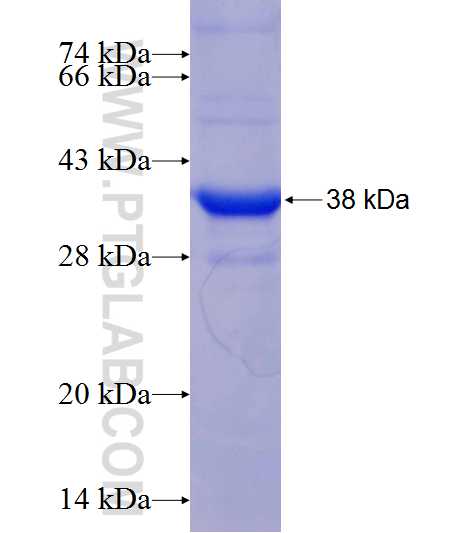 UGT1A6 fusion protein Ag20635 SDS-PAGE