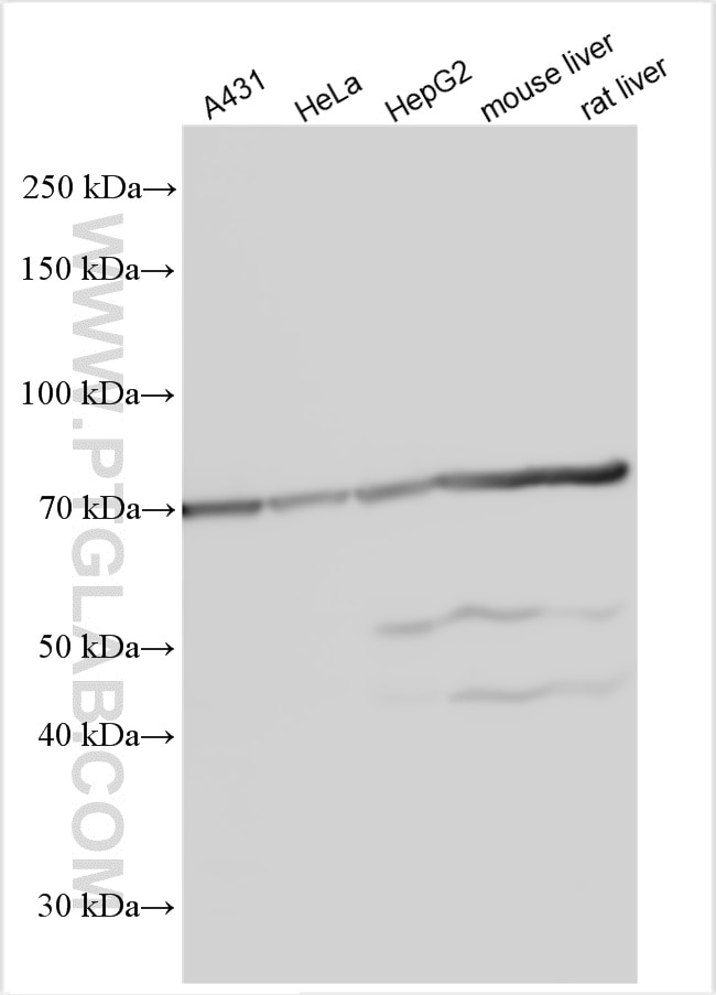 Western Blot (WB) analysis of various lysates using UGT1A9 Polyclonal antibody (16663-1-AP)