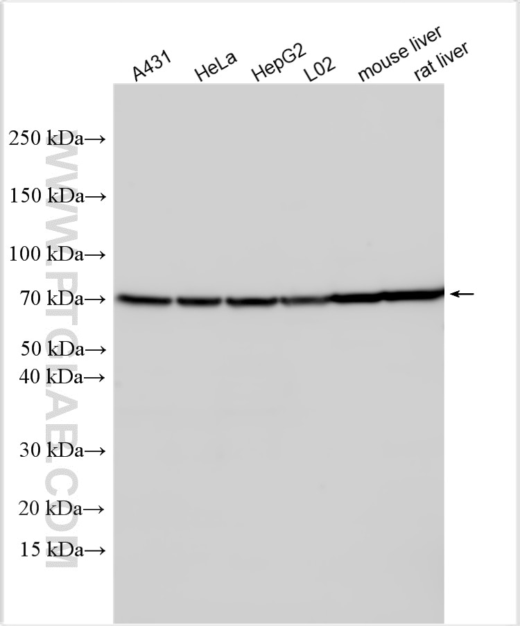 Western Blot (WB) analysis of various lysates using UGT1A9 Polyclonal antibody (16663-1-AP)