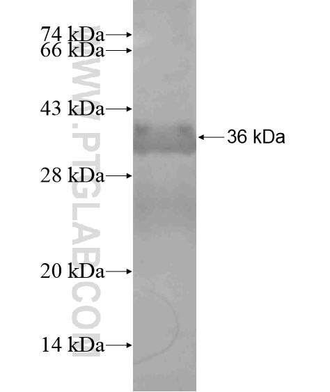 UGT2A1 fusion protein Ag19421 SDS-PAGE