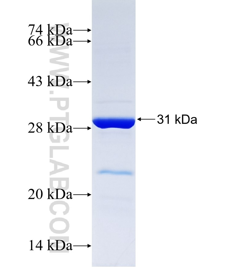 UGT2B10 fusion protein Ag37373 SDS-PAGE UGT2B10 fusion protein Ag37373 SDS-PAGE