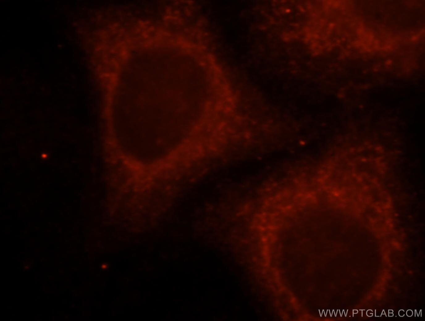 Immunofluorescence (IF) / fluorescent staining of HepG2 cells using UGT2B4 Polyclonal antibody (15425-1-AP)