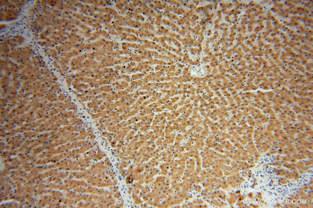 Immunohistochemistry (IHC) staining of human liver tissue using UGT2B4 Polyclonal antibody (15425-1-AP)