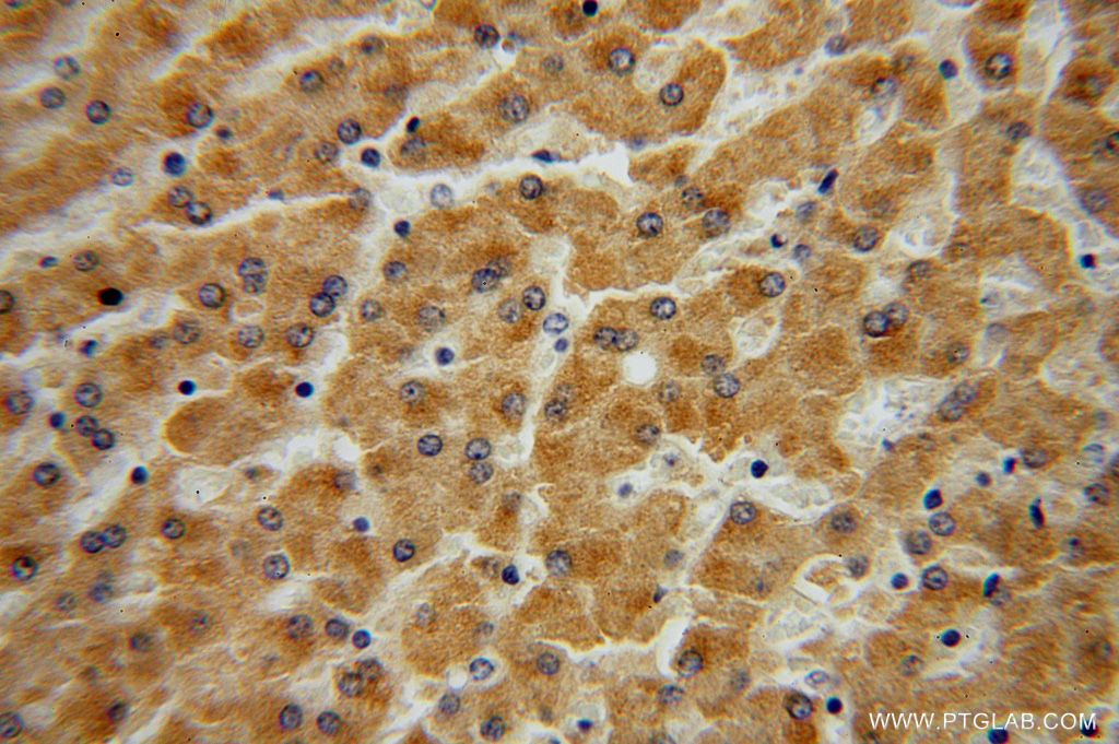 IHC staining of human liver using 15425-1-AP
