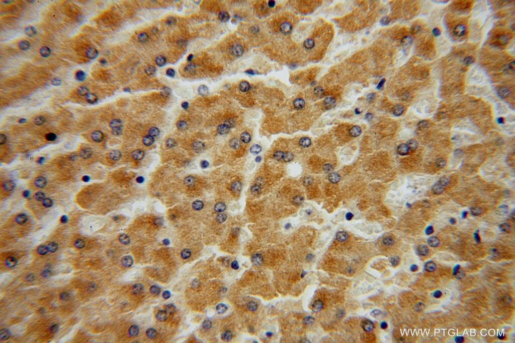 Immunohistochemistry (IHC) staining of human liver tissue using UGT2B4 Polyclonal antibody (15425-1-AP)