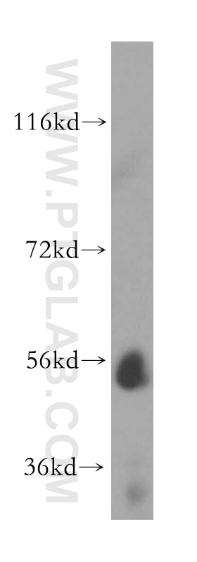 Western Blot (WB) analysis of human liver tissue using UGT2B4 Polyclonal antibody (15425-1-AP)