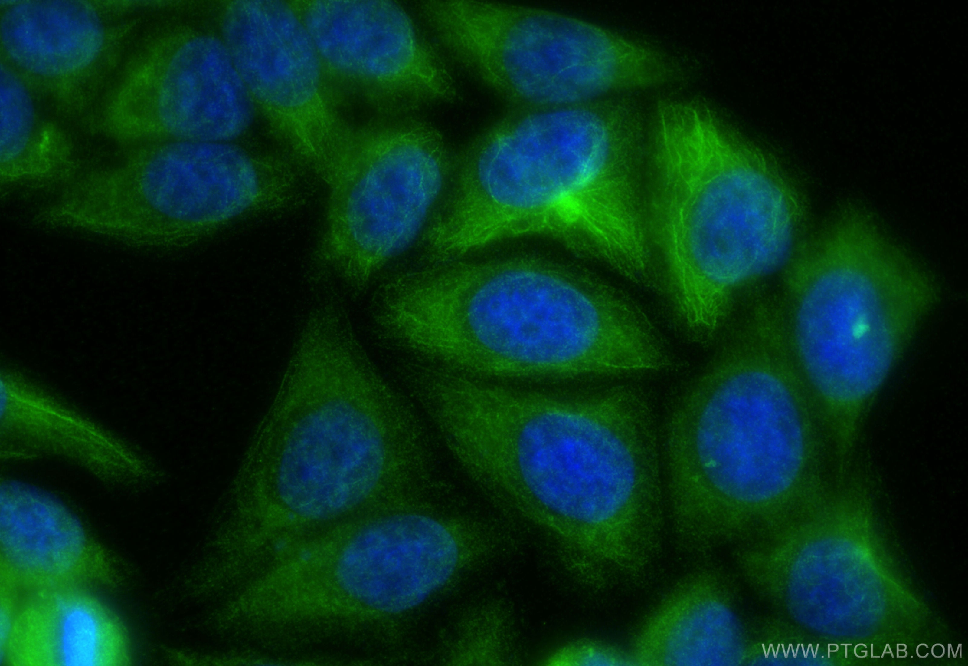 Immunofluorescence (IF) / fluorescent staining of HepG2 cells using UGT2B7 Polyclonal antibody (16661-1-AP)