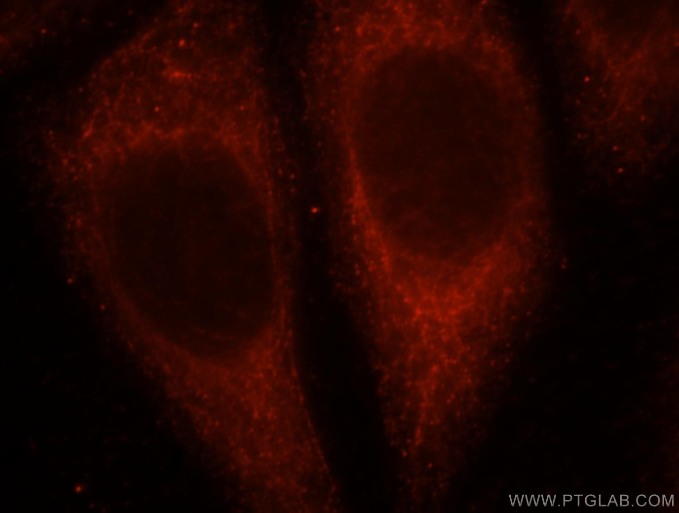 Immunofluorescence (IF) / fluorescent staining of HepG2 cells using UGT2B7 Polyclonal antibody (16661-1-AP)