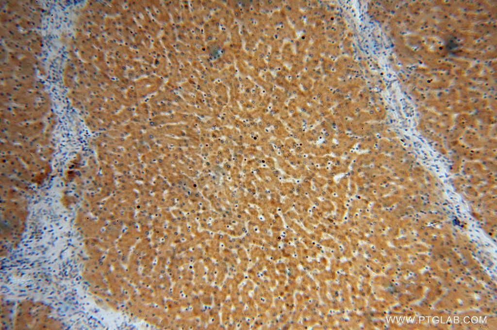 Immunohistochemistry (IHC) staining of human liver tissue using UGT2B7 Polyclonal antibody (16661-1-AP)