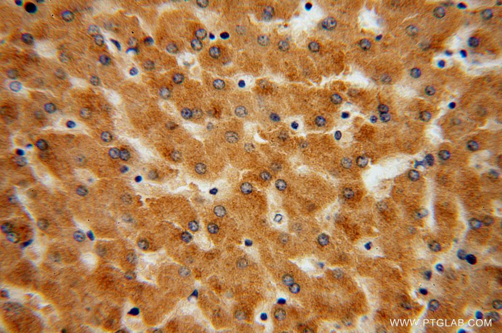 Immunohistochemistry (IHC) staining of human liver tissue using UGT2B7 Polyclonal antibody (16661-1-AP)