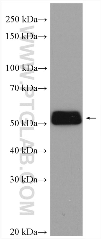 Western Blot (WB) analysis of various lysates using UGT2B7 Polyclonal antibody (16661-1-AP)