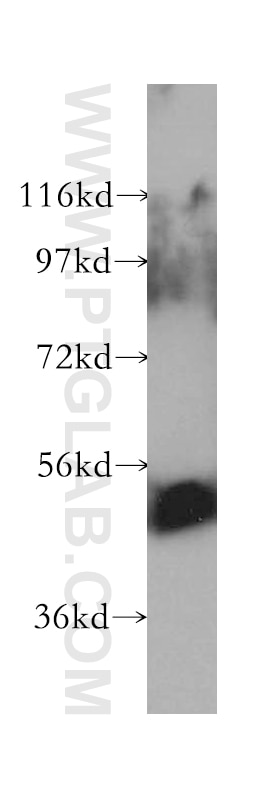 Western Blot (WB) analysis of HEK-293 cells using UGT2B7 Polyclonal antibody (16661-1-AP)