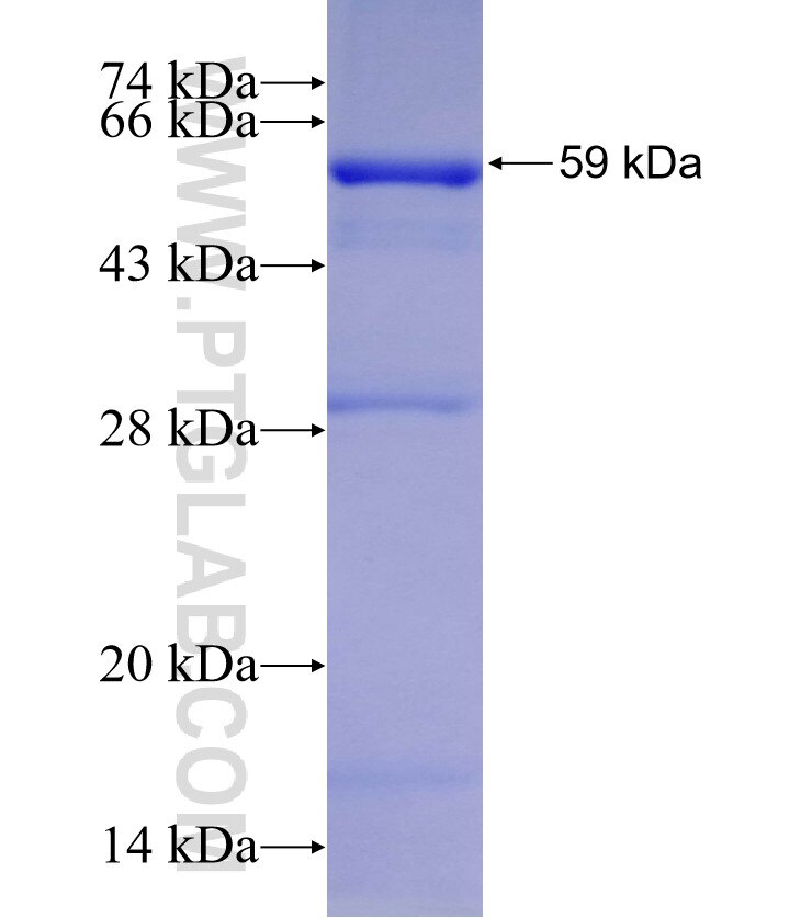UGT2B7 fusion protein Ag10121 SDS-PAGE