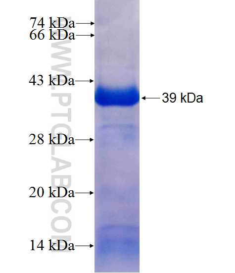 UGT2B7 fusion protein Ag10122 SDS-PAGE