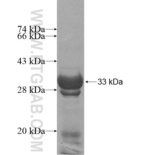 UGT3A1 fusion protein Ag11020 SDS-PAGE
