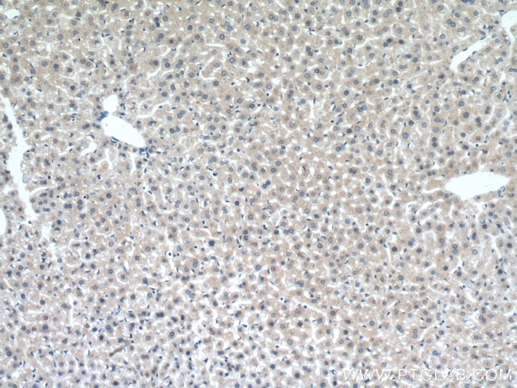 Immunohistochemistry (IHC) staining of mouse liver tissue using UGT3A2 Polyclonal antibody (21366-1-AP)