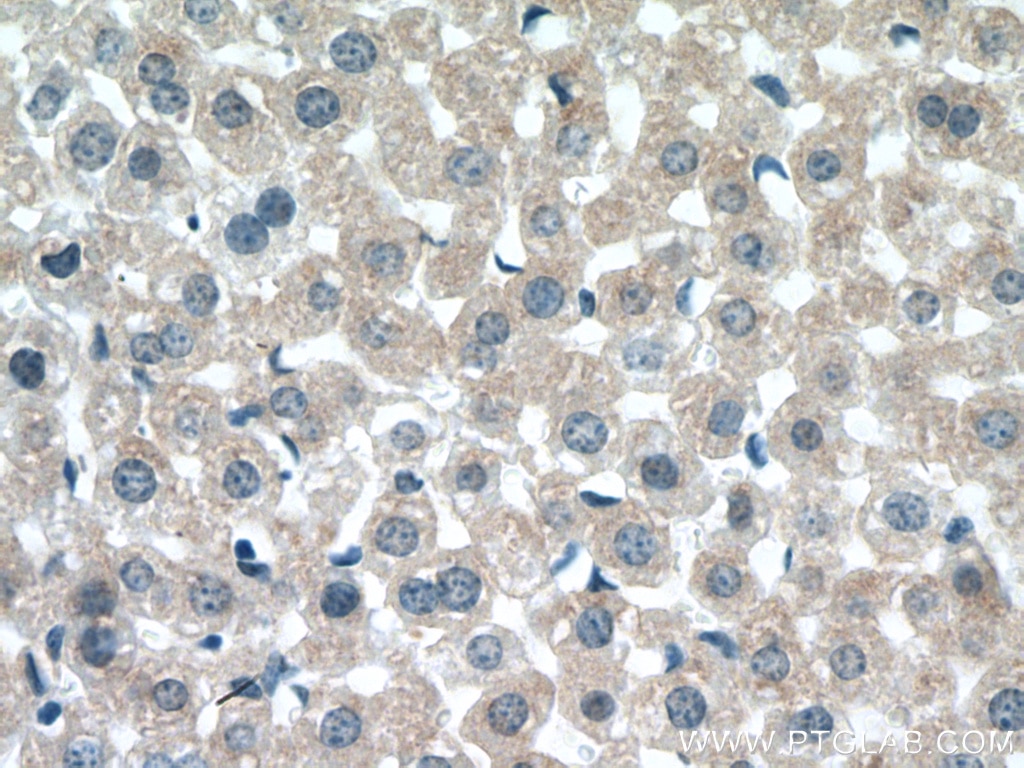 Immunohistochemistry (IHC) staining of mouse liver tissue using UGT3A2 Polyclonal antibody (21366-1-AP)