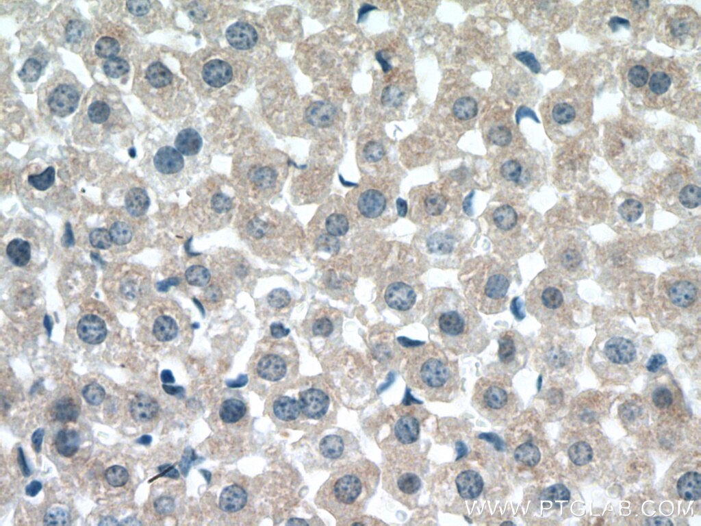 IHC staining of mouse liver using 21366-1-AP