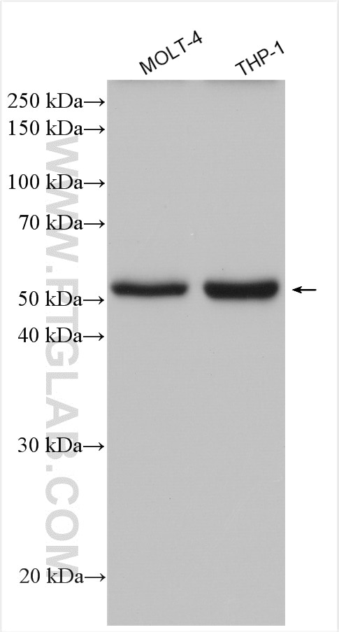 Western Blot (WB) analysis of various lysates using UGT3A2 Polyclonal antibody (21366-1-AP)