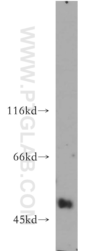 Western Blot (WB) analysis of human testis tissue using UGT3A2 Polyclonal antibody (21366-1-AP)