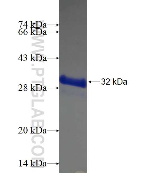 UGT3A2 fusion protein Ag15835 SDS-PAGE