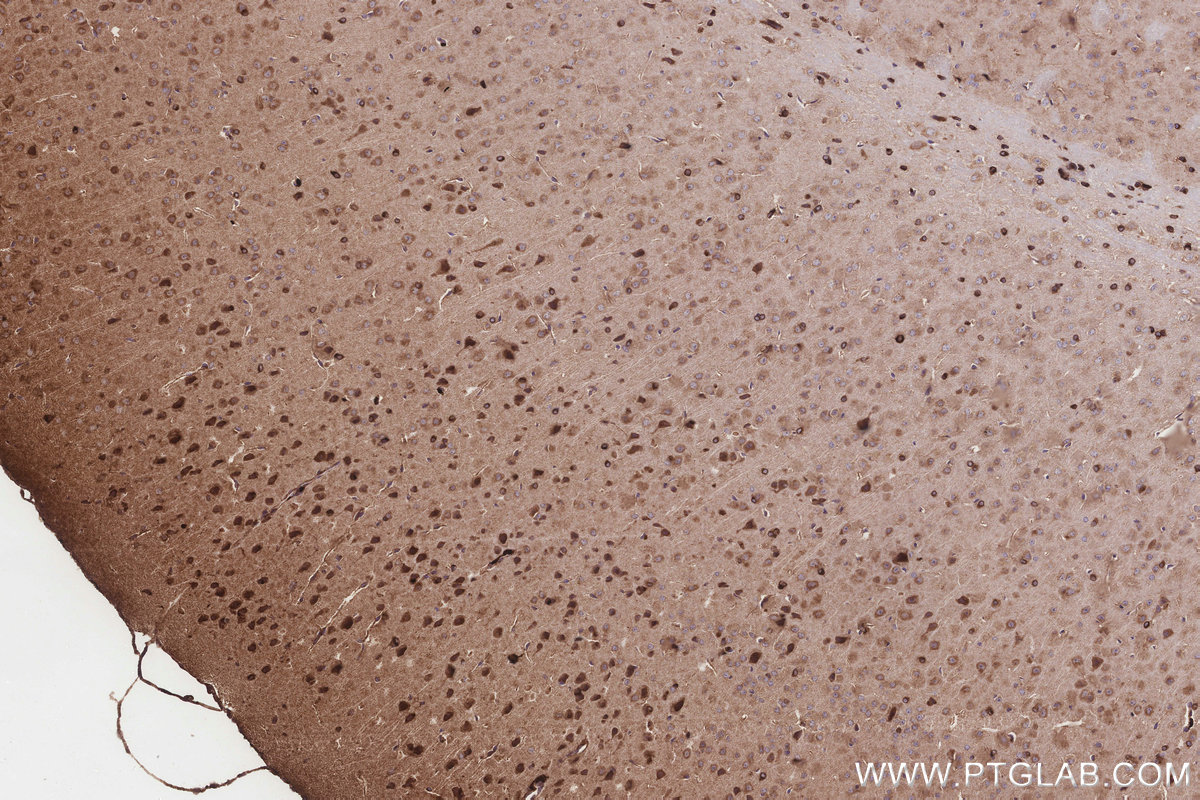 Immunohistochemistry (IHC) staining of mouse brain tissue using UGT8 Polyclonal antibody (17982-1-AP)