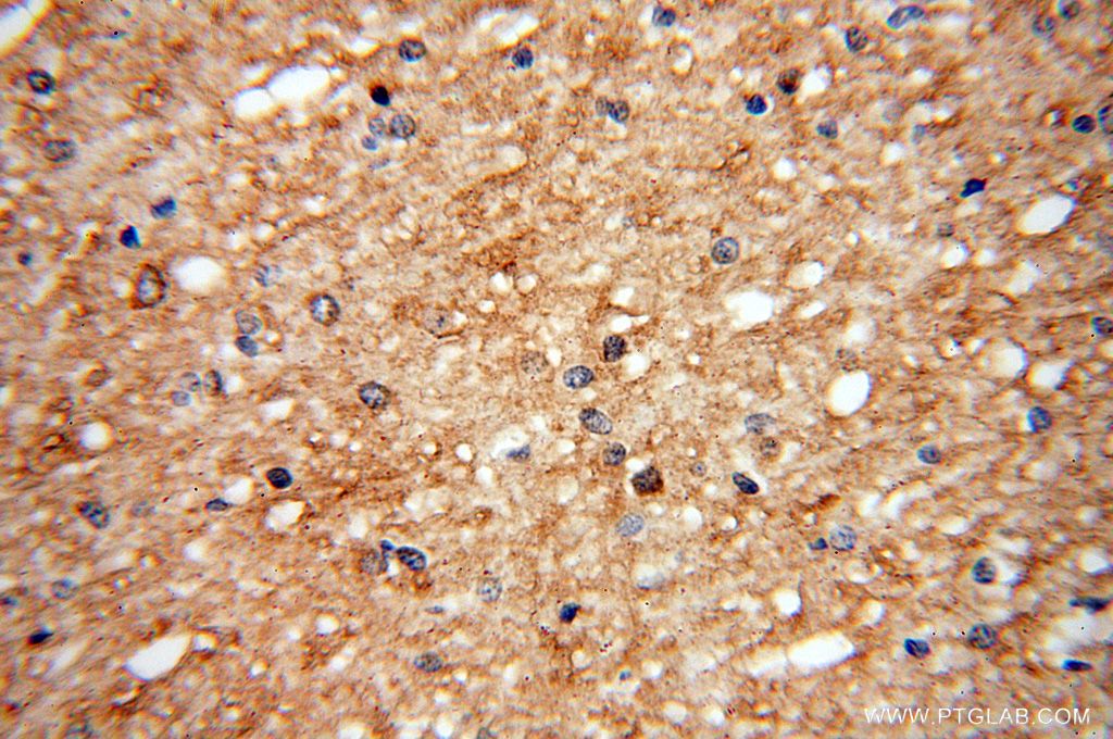 Immunohistochemistry (IHC) staining of human brain tissue using UGT8 Polyclonal antibody (17982-1-AP)