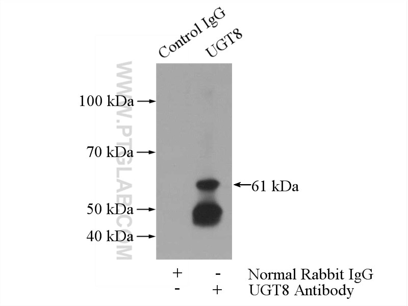 Immunoprecipitation (IP) experiment of rat brain tissue using UGT8 Polyclonal antibody (17982-1-AP)