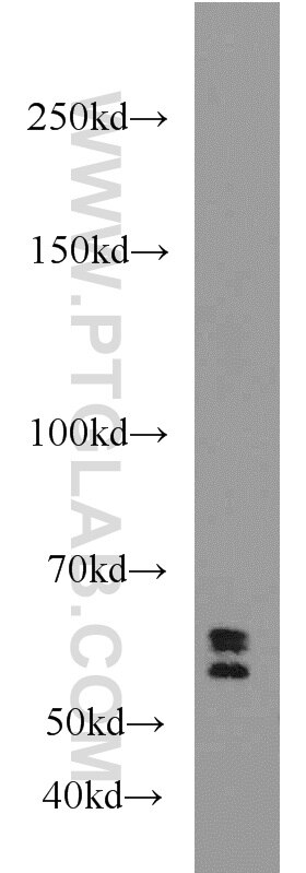 Western Blot (WB) analysis of mouse brain tissue using UGT8 Polyclonal antibody (17982-1-AP)