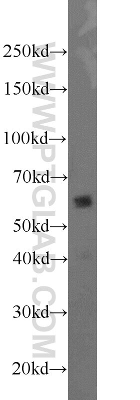 Western Blot (WB) analysis of rat brain tissue using UGT8 Polyclonal antibody (17982-1-AP)