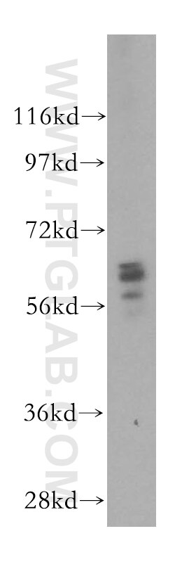 Western Blot (WB) analysis of mouse cerebellum tissue using UGT8 Polyclonal antibody (17982-1-AP)