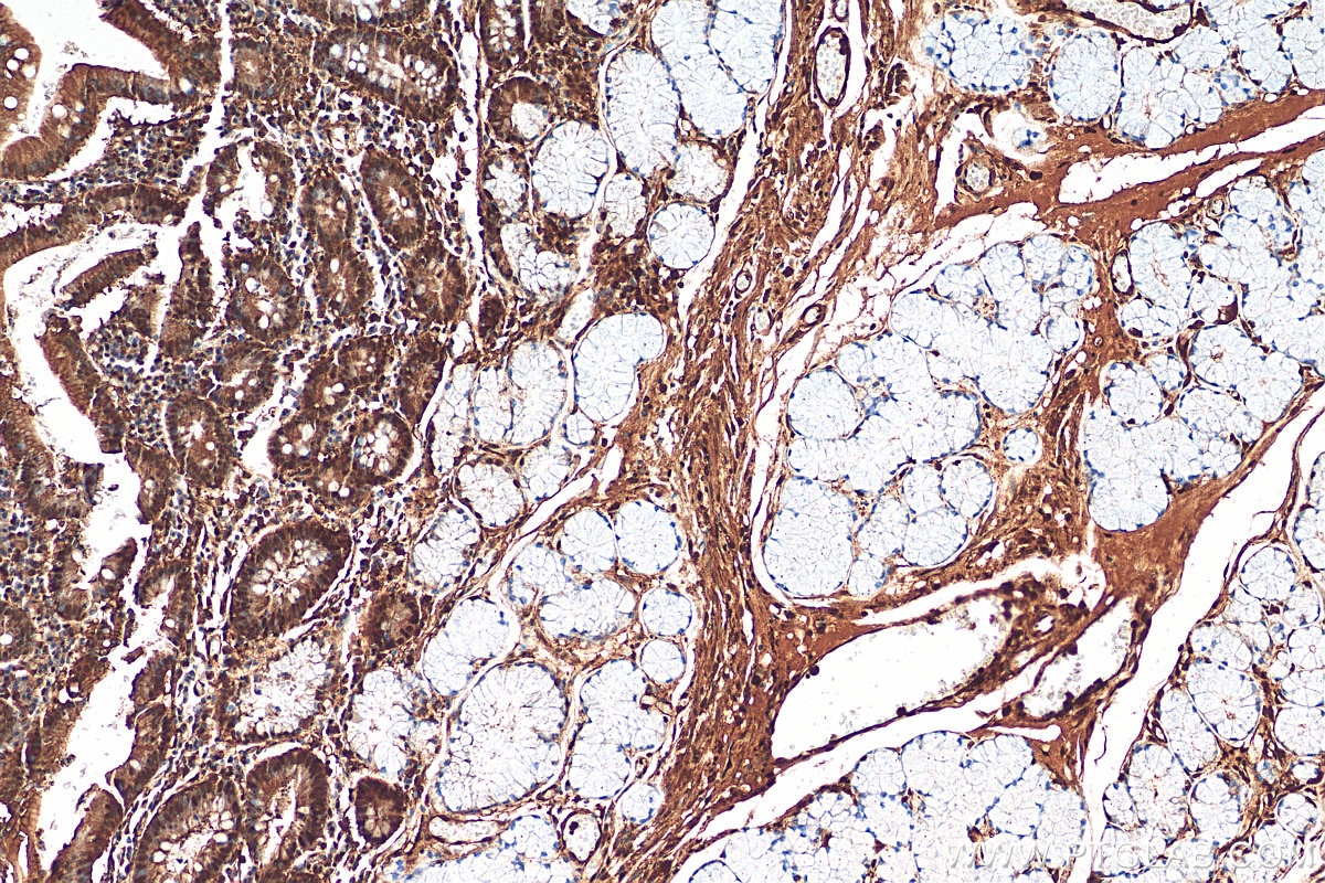 Immunohistochemistry (IHC) staining of human stomach tissue using UHMK1 Polyclonal antibody (11624-1-AP)