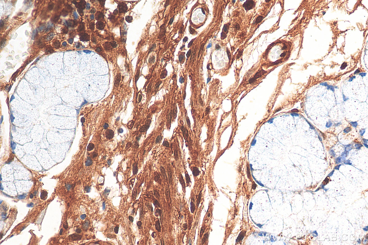 Immunohistochemistry (IHC) staining of human stomach tissue using UHMK1 Polyclonal antibody (11624-1-AP)