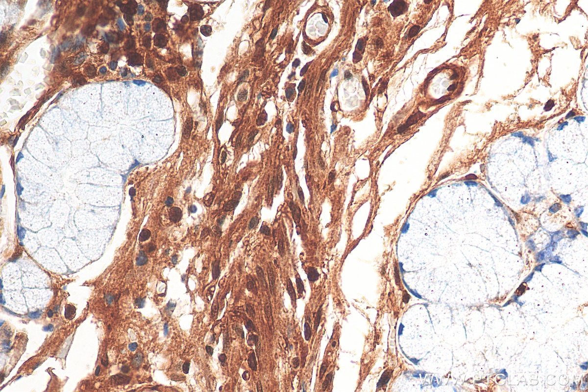 Immunohistochemistry (IHC) staining of human stomach tissue using UHMK1 Polyclonal antibody (11624-1-AP)