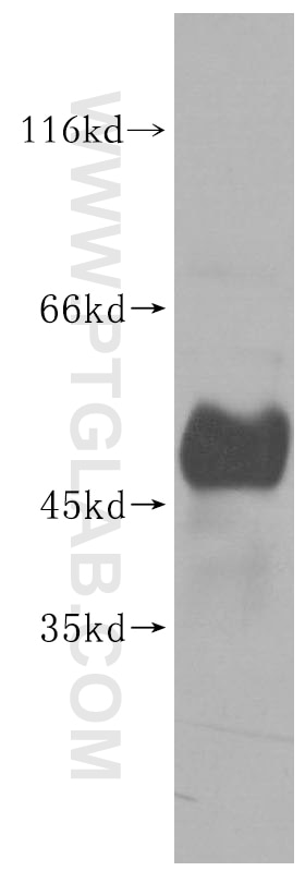 Western Blot (WB) analysis of mouse thymus tissue using UHMK1 Polyclonal antibody (11624-1-AP)