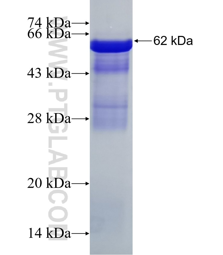 UHMK1 fusion protein Ag2204 SDS-PAGE