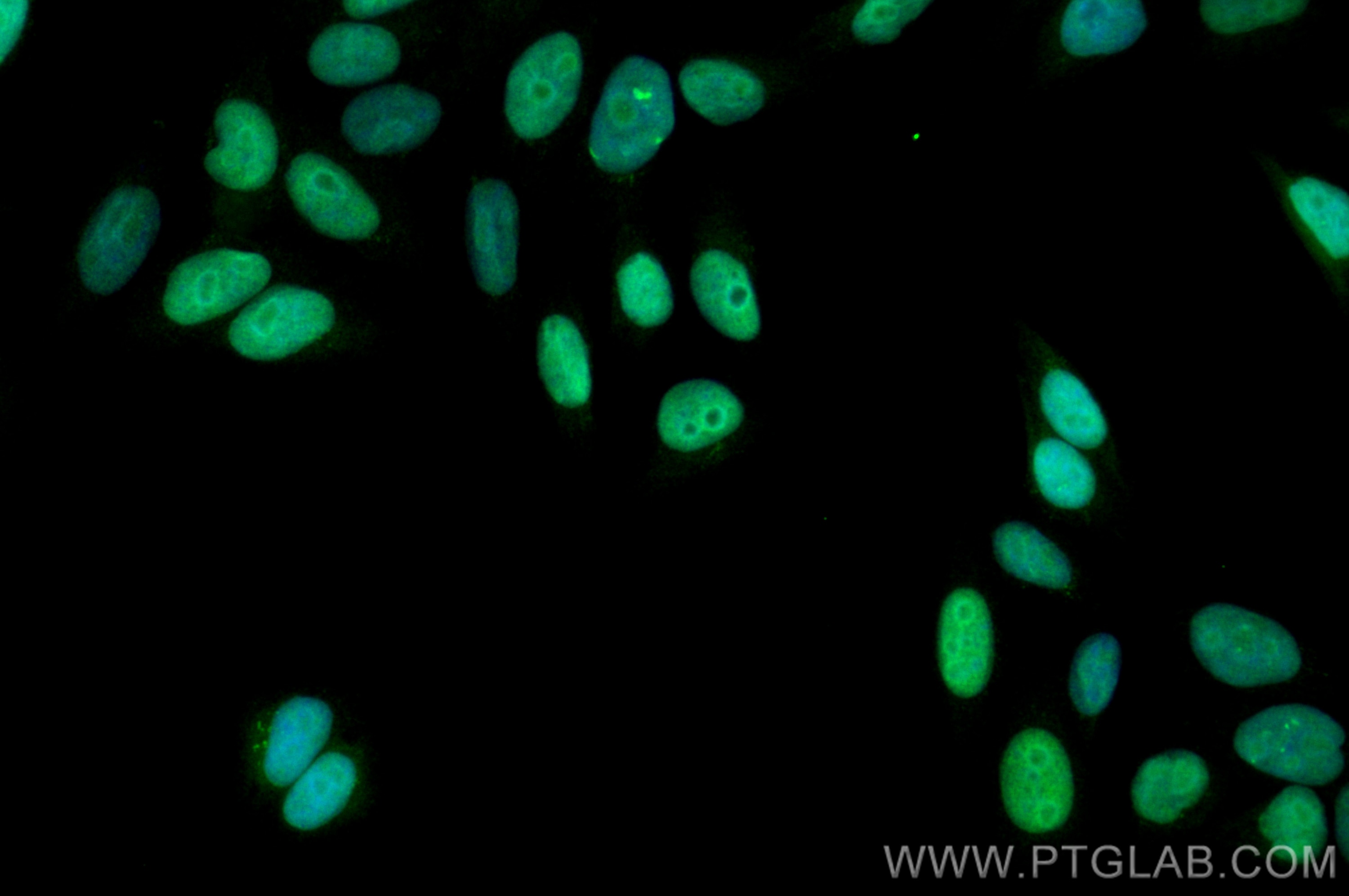 Immunofluorescence (IF) / fluorescent staining of HepG2 cells using UHRF1 Polyclonal antibody (21402-1-AP)