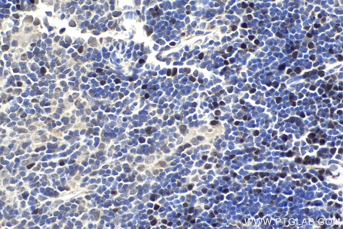 IHC staining of mouse thymus using 21402-1-AP Immunohistochemistry (IHC) staining of mouse thymus tissue using UHRF1 Polyclonal antibody (21402-1-AP)