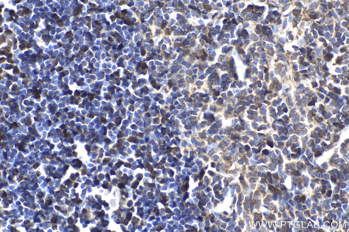 IHC staining of rat thymus using 21402-1-AP Immunohistochemistry (IHC) staining of rat thymus tissue using UHRF1 Polyclonal antibody (21402-1-AP)
