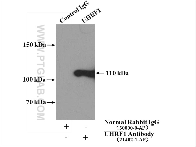 Immunoprecipitation (IP) experiment of HeLa cells using UHRF1 Polyclonal antibody (21402-1-AP)