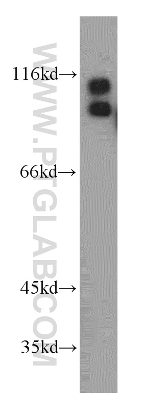 Western Blot (WB) analysis of MCF-7 cells using UHRF1 Polyclonal antibody (21402-1-AP)