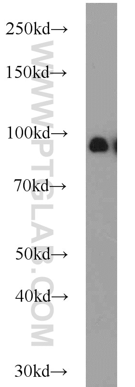 Western Blot (WB) analysis of HeLa cells using UHRF1 Polyclonal antibody (21402-1-AP)