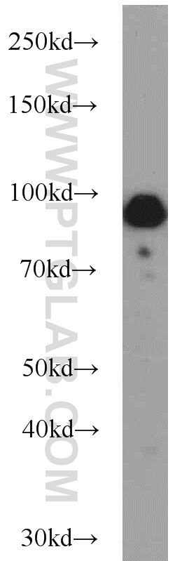 Western Blot (WB) analysis of HeLa cells using UHRF1 Polyclonal antibody (21402-1-AP)