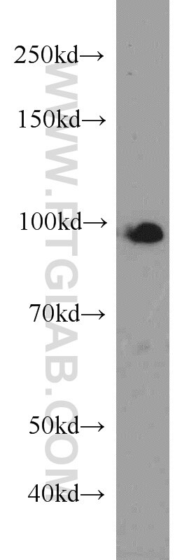 Western Blot (WB) analysis of HeLa cells using UHRF1 Polyclonal antibody (21402-1-AP)