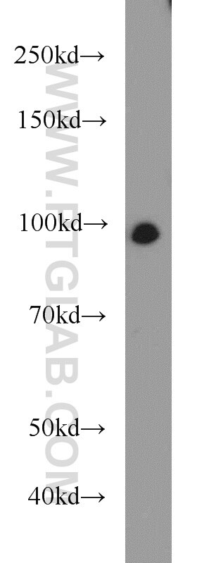 WB analysis of HeLa using 21402-1-AP